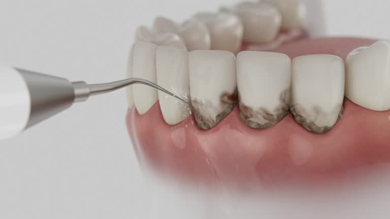 Reliable Wisdom Tooth Removal contractor in Rhea County County, TN by Dentist Open Now